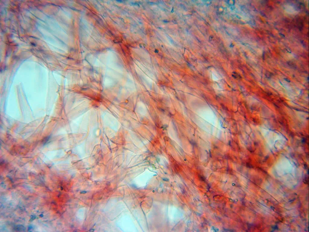 Microscopía de Psilocybe coronilla - 6 - Cutíula x 400 2